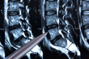 Wirbelsäule Untersuchung Radiologe